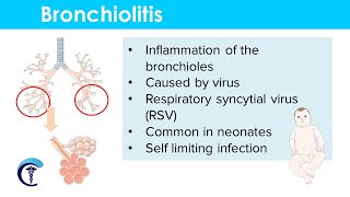 Bronchial Breath Sounds  Lung Sounds  Medzcool [upl. by Dania]