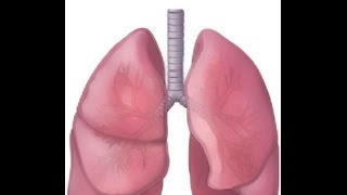 Bronchiectasis Causes amp Treatment  SLUCare Pulmonary [upl. by Jillian]