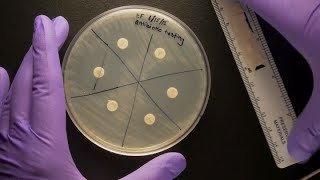 ID Laboratory Videos Antibiotic susceptibility testing [upl. by Jeth303]