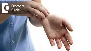 How to treat rashes on hands  Dr Rasya Dixit [upl. by Ecilahs]