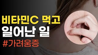 비타민C 먹고 피부가 가렵다면 이것이 원인 입니다 [upl. by Erdnoed]