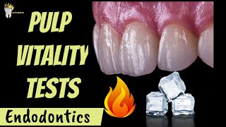 ENDODONTICS  PULP VITALITY TESTS MADE EASY [upl. by Klepac]