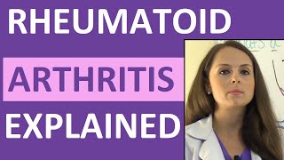 Rheumatoid Arthritis Treatment Options [upl. by Rudwik]