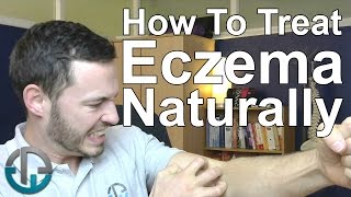 How To Treat Eczema Naturally [upl. by Ydniahs]